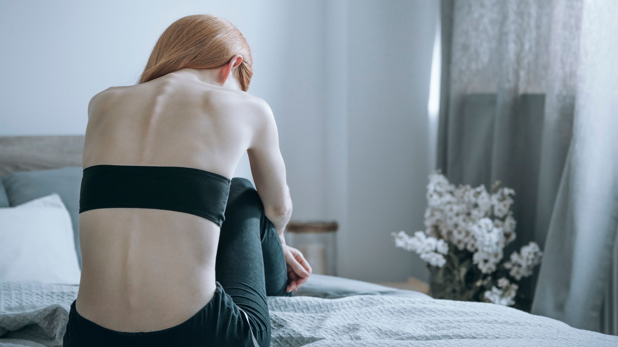Anorexia nerviosa