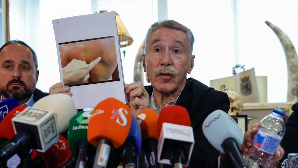 Marcos García Montes montrant les blessures de Daniel Sancho après la prétendue bagarre avec Edwin Arrieta