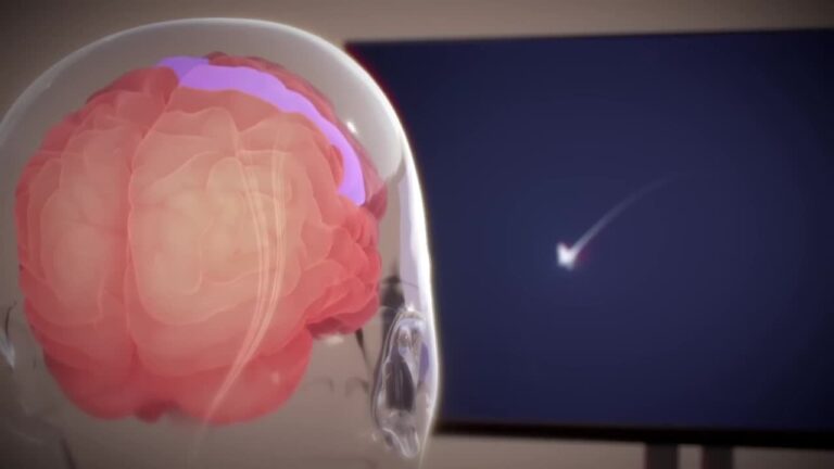 Neuralink d&rsquo;Elon Musk implante la première puce cérébrale chez un humain