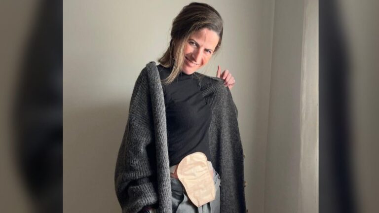 Patricia vit avec un sac dans le ventre pour faire ses besoins