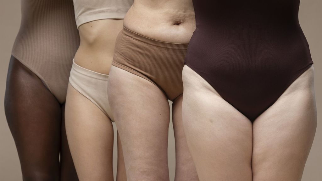Femmes atteintes de lipœdème
