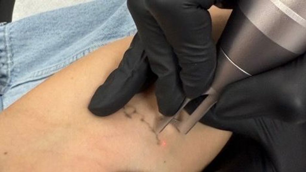 Adara Molinéro élimine tous ses tatouages